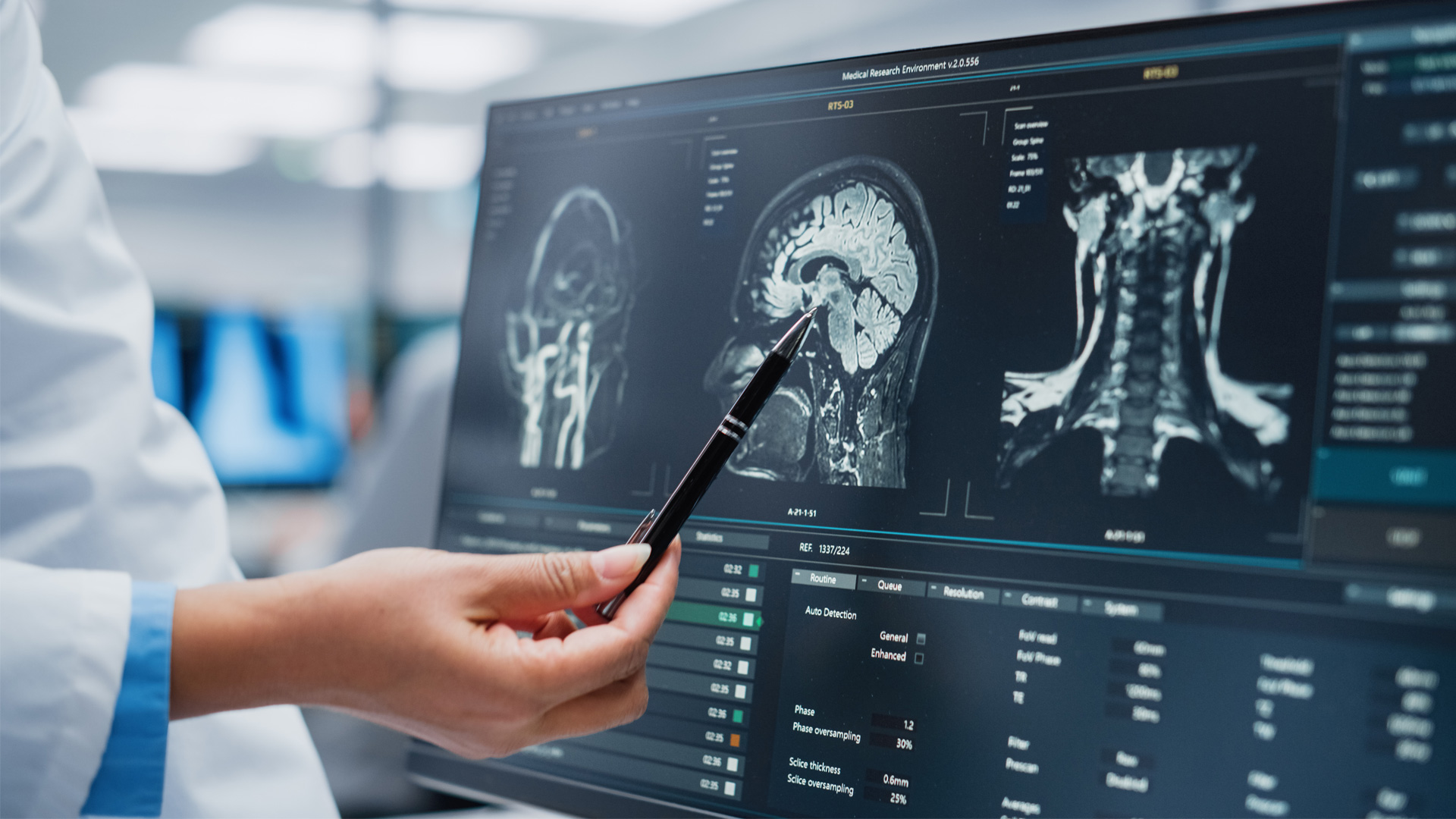 Introduction to Neuroscience in Early Years East Sussex College